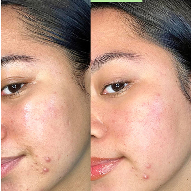 Oil Control Clearing Face Mask