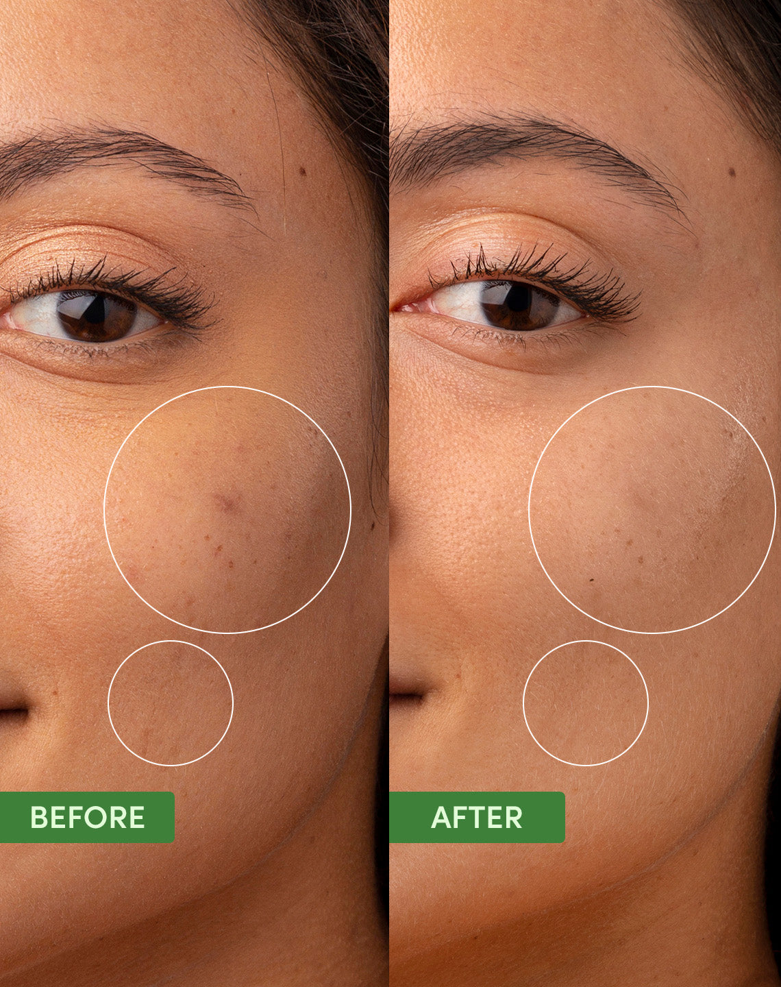 Oil Control Clearing Moisturiser