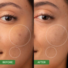 Oil Control Clearing Moisturiser Thumb 1