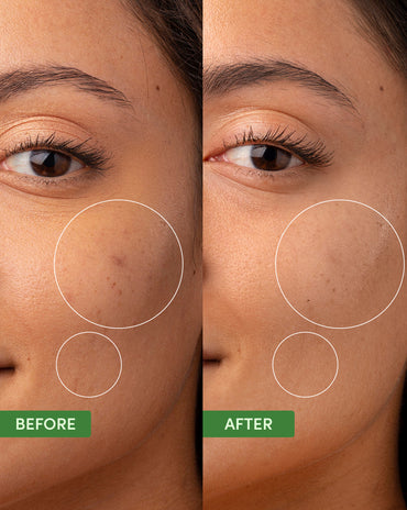 Oil Control Clearing Moisturiser