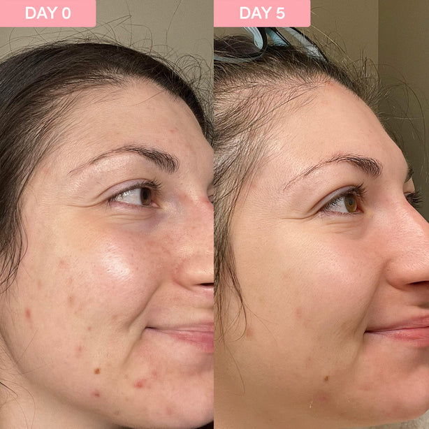 Pro Youth Dark Spot Serum